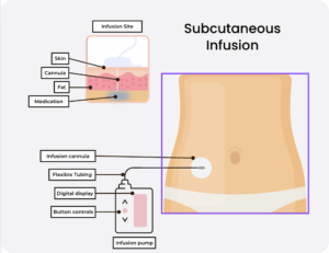 Zolfran Injection Taking Ondansetron/Zofran Patient Resource - HER Foundation